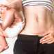 What to Expect: A Guide to Physical Recovery After Cesarean Birth